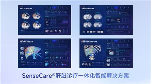 商湯醫療獲肝臟CT輔助診斷NMPA三類證，軟硬件零售賦能肝臟診療一體化新格局